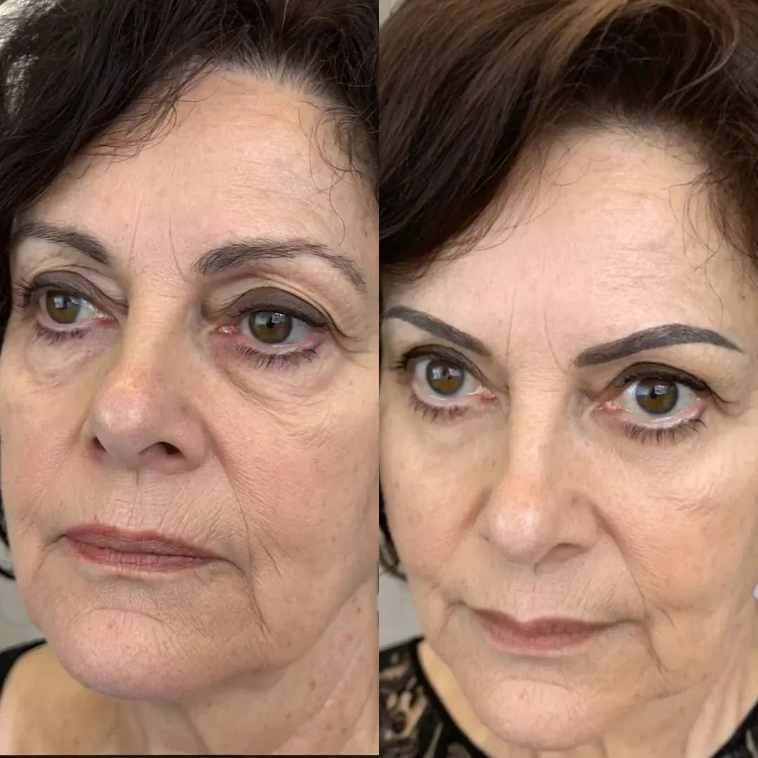 RevitalEyes® 2-en-1 contre les Poches Sous les Yeux
