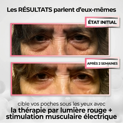 RevitalEyes® 2-en-1 contre les Poches Sous les Yeux